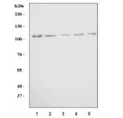 Western blot testing of human 1) HeLa, 2) 293T, 3) Daudi, 4) T-47D and 5) RT-4 cell lysate with LNPEP antibody. Predicted molecular weight ~117 kDa.
