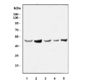 Western blot testing of 1) human HepG2, 2) human MCF7, 3) human SiHa, 4) monkey COS-7 and 5) mouse HEPA1-6 cell lysate with MLX antibody. Predicted molecular weight ~33 kDa, commonly observed at 30-50 kDa.