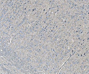 IHC staining of FFPE rat brain tissue with NEDD4 antibody. HIER: boil tissue sections in pH8 EDTA for 20 min and allow to cool before testing.