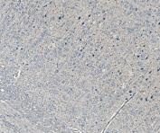 IHC staining of FFPE rat brain tissue with NEDD4 antibody. HIER: boil tissue sections in pH8 EDTA for 20 min and allow to cool before testing.