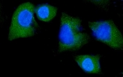 Immunofluorescent staining of FFPE human A549 cells with NEDD4 antibody (green) and DAPI nuclear stain (blue). HIER: steam section in pH6 citrate buffer for 20 min.