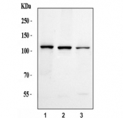 Western blot testing of human 1) U-251, 2) RT-4 and 3) HaCat cell lysate with NEDD4 antibody. Predicted molecular weight ~149 kDa; commonly observed at 110-149 kDa with a possible ~95 kDa cleavage band.