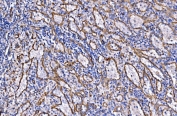 IHC staining of FFPE human splenic rupture tissue with NLRP7 antibody. HIER: boil tissue sections in pH8 EDTA for 20 min and allow to cool before testing.