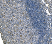 IHC staining of FFPE human tonsil tissue with NLRP7 antibody. HIER: boil tissue sections in pH8 EDTA for 20 min and allow to cool before testing.