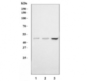Western blot testing of human 1) HaCat, 2) HepG2 and 3) MCF7 cell lysate with P2Y6 antibody. Predicted molecular weight ~36 kDa, commonly observed from 36-55 kDa.