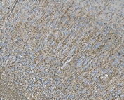 IHC staining of FFPE rat brain tissue with RAB13 antibody. HIER: boil tissue sections in pH8 EDTA for 20 min and allow to cool before testing.