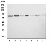 Western blot testing of 1) human K562, 2) human HeLa, 3) human MCF7, 4) human Jurkat, 5) rat testis, 6) mouse testis and 7) mouse lung tissue lysate with hHR23A antibody. Predicted molecular weight ~40 kDa but commonly observed at 40-55 kDa and possibly larger due to ubiquitination.