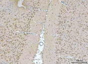 IHC staining of FFPE rat brain tissue with Rbfox3 antibody. HIER: boil tissue sections in pH8 EDTA for 20 min and allow to cool before testing.