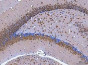 IHC staining of FFPE mouse brain tissue with Rbfox3 antibody. HIER: boil tissue sections in pH8 EDTA for 20 min and allow to cool before testing.