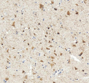 IHC staining of FFPE human brain tissue with Rbfox3 antibody. HIER: boil tissue sections in pH8 EDTA for 20 min and allow to cool before testing.
