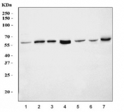 Western blot testing of 1) human MOLT-4, 2) human U-2 OS, 3) human HL60, 4) human U-251, 5) human 293T, 6) human placenta and 7) mouse NIH 3T3 cell lysate with RPS6KB1 antibody. Predicted molecular weight: ~59 kDa, routinely observed at 59-70 kDa.