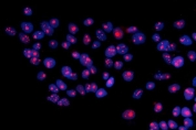 Immunofluorescent staining of FFPE human A431 cells with RRS1 antibody (red) and DAPI nuclear stain (blue). HIER: steam section in pH6 citrate buffer for 20 min.