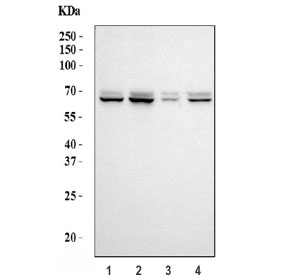 Western blot testing of human 1) 293T, 2) HepG2, 3) K562 and 4) HCCT cell lysate with SERPINF2 antibody. Predicted molecular weight: ~55 kDa (isoform 1) and ~48 kDa (isoform 2), but can be observed at 55-65 kDa depending on glycosylation level.
