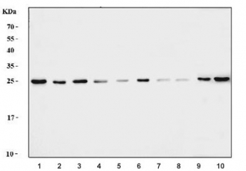 Western blot testing of 1) human HeLa, 2) human Caco-2, 3) human 293T, 4) human HepG2, 5) human A549, 6) human COLO-320, 7) human U-87 MG, 8) monkey COS-7, 9) mouse liver and mouse C2C12 cell lysate with Sigma1-receptor antibody. Predicted molecular weight ~25 kDa.