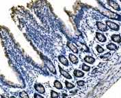 IHC staining of FFPE rat colon tissue with Sigma1-receptor antibody. HIER: boil tissue sections in pH8 EDTA for 20 min and allow to cool before testing.
