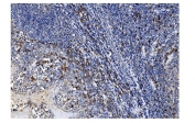IHC staining of FFPE human tonsil tissue with SLAMF1 antibody. HIER: boil tissue sections in pH8 EDTA for 20 min and allow to cool before testing.
