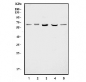 Western blot testing of human 1) 293T, 2) MCF7, 3) HepG2, 4) Caco-2 and 5) A431 cell lysate with SLC6A3 antibody. Predicted molecular weight: 68-80 kDa depending on level of glycosylation.