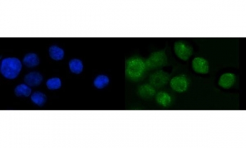 Immunofluorescent staining of FFPE human Caco-2 cells with KLF14 antibody (green) and DAPI nuclear stain (blue). HIER: steam section in pH6 citrate buffer for 20 min.