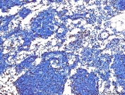 IHC staining of FFPE mouse lymph gland tissue with SPI1 antibody. HIER: boil tissue sections in pH8 EDTA for 20 min and allow to cool before testing.