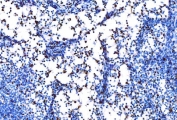 IHC staining of FFPE rat lymph gland tissue with SPI1 antibody. HIER: boil tissue sections in pH8 EDTA for 20 min and allow to cool before testing.
