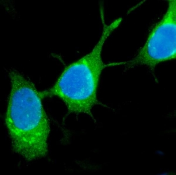 Immunofluorescent staining of FFPE human MCF7 cells with Estrogen Inducible Protein pS2 antibody (green) and DAPI nuclear stain (blue). HIER: steam section in pH6 citrate buffer for 20 min.~
