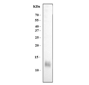 Western blot testing of human MCF7 cell lysate with Estr