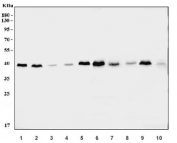 Western blot testing of 1) human MCF7, 2) human HeLa, 3) human HepG2, 4) human RT-4, 5) human PC-3, 6) rat testis, 7) rat kidney, 8) rat brain, 9) mouse testis and 10) mouse kidney tissue lysate with GDP-L-fucose synthase antibody. Predicted molecular weight ~36 kDa.