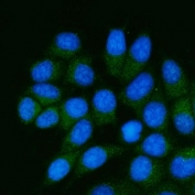 Immunofluorescent staining of FFPE human MCF7 cells with GDP-L-fucose synthase antibody (green) and DAPI nuclear stain (blue). HIER: steam section in pH6 citrate buffer for 20 min.