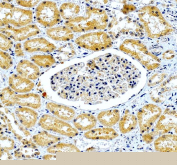 IHC staining of FFPE human kidney tissue with GDP-L-fucose synthase antibody, HRP-secondary and DAB substrate. HIER: boil tissue sections in pH8 EDTA for 20 min and allow to cool before testing.
