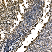 IHC staining of FFPE human tonsil tissue with WAPL antibody. HIER: boil tissue sections in pH8 EDTA for 20 min and allow to cool before testing.