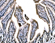 IHC staining of FFPE mouse colon tissue with WAPL antibody. HIER: boil tissue sections in pH8 EDTA for 20 min and allow to cool before testing.