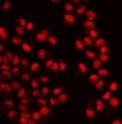 Immunofluorescent staining of FFPE human T-47D cells with WAPL antibody. HIER: steam section in pH6 citrate buffer for 20 min.