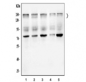 Western blot testing of 1) human HeLa, 2) human 293T, 3) human HepG2, 4) rat L6 and 5) mouse C2C12 cell lysate with WAPL antibody. Predicted molecular weight: 133-143 kDa but can be observed at 160-180 kDa due to phosphorylation.