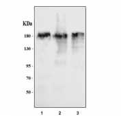 Western blot testing of human 1) K562, 2) HEL and 3) A549 cell lysate with ZNF609 antibody. Predicted molecular weight ~151 kDa.