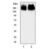 Western blot testing of human 1) DLD1 and 2) HUH-7 cell lysate with P Glycoprotein antibody. Expected molecular weight: 141-180 kDa depending on glycosylation level.