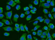 Immunofluorescent staining of FFPE human HeLa cells with ACADM antibody (green) and DAPI nuclear stain (blue). HIER: steam section in pH6 citrate buffer for 20 min.