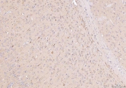 IHC staining of FFPE mouse brain tissue with NDUFB8 antibody. HIER: boil tissue sections in pH8 EDTA for 20 min and allow to cool before testing.