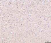 IHC staining of FFPE rat brain tissue with NDUFB8 antibody. HIER: boil tissue sections in pH8 EDTA for 20 min and allow to cool before testing.
