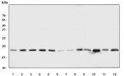 Western blot testing of 1) human HeLa, 2) human 293T, 3) human A549, 4) human HepG2, 5) human Caco-2, 6) human U937, 7) human PC-3, 8) human HL60, 9) rat liver, 10) rat heart, 11) mouse liver and 12) mouse heart tissue lysate with NDUFB8 antibody. Expected molecular weight: 18-22 kDa (multiple isoforms).