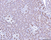 IHC staining of FFPE mouse kidney tissue with ACP3 antibody. HIER: boil tissue sections in pH8 EDTA for 20 min and allow to cool before testing.