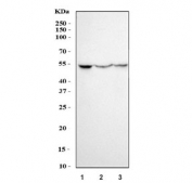 Western blot testing of 1) human HepG2, 2) mouse brain and 3) rat brain tissue lysate with ROR beta antibody. Predicted molecular weight ~53 kDa.