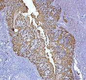 IHC staining of FFPE human tonsil tissue with MASPIN antibody. HIER: boil tissue sections in pH8 EDTA for 20 min and allow to cool before testing.