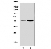 Western blot testing of human 1) MCF-7 and 2) PC-3 cell lysate with Neurotensin Receptor 1 antibody. Predicted molecular weight ~43 kDa.