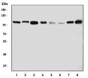 Western blot testing of 1) human HeLa, 2) human 293T, 3) human K562, 4) human SK-O-V3, 5) rat brain, 6) rat PC-12, 7) mouse brain and 8) mouse NIH 3T3 cell lysate with HRS antibody. Predicted molecular weight ~86 kDa, commonly observed at 110-115 kDa.