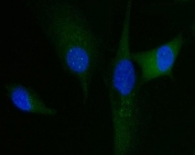 Immunofluorescent staining of FFPE human U-87 MG cells with HGF-regulated tyrosine kinase substrate antibody (green) and DAPI nuclear stain (blue). HIER: steam section in pH6 citrate buffer for 20 min.