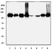 Western blot testing of 1) human HeLa, 2) human 293T, 3) human K562, 4) human SK-O-V3, 5) rat brain, 6) rat PC-12, 7) mouse brain and 8) mouse NIH 3T3 cell lysate with HGF-regulated tyrosine kinase substrate antibody. Predicted molecular weight ~86 kDa, commonly observed at 110-115 kDa.