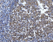 IHC staining of FFPE human tonsil tissue with YWHAE antibody. HIER: boil tissue sections in pH8 EDTA for 20 min and allow to cool before testing.