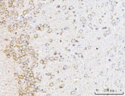 IHC staining of FFPE rat brain tissue with YWHAE antibody. HIER: boil tissue sections in pH8 EDTA for 20 min and allow to cool before testing.