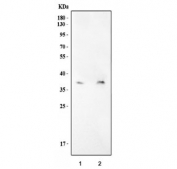 Western blot testing of mouse 1) RAW264.7 and 2) NIH 3T3 cell lysate with Aim2 antibody. Predicted molecular weight ~39 kDa.