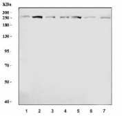 Western blot testing of 1) human HeLa, 2) human HepG2, 3) human 293T, 4) human Jurkat, 5) rat brain, 6) mouse brain and 7) mouse lung lysate with TAF1 antibody. Expected molecular weight ~250 kDa.